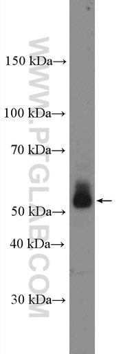 [17336-1-AP-20UL] CD1d Polyclonal antibody