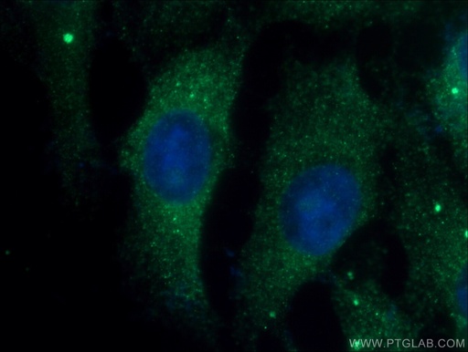 [17337-1-AP-150UL] JNK2 Polyclonal antibody