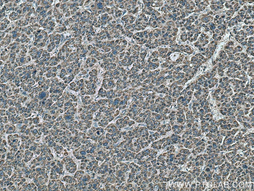 [17340-1-AP-20UL] MEK4 Polyclonal antibody