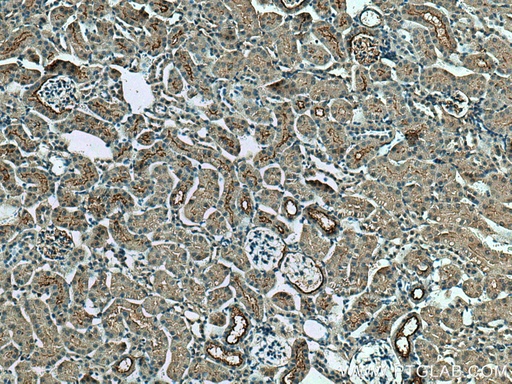 [17341-1-AP-20UL] SLC5A10 Polyclonal antibody