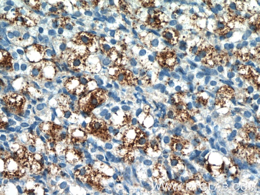 [17343-1-AP-150UL] PLAC1L Polyclonal antibody