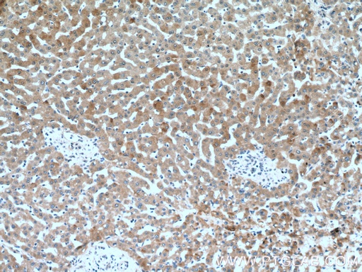 [17346-1-AP-20UL] C1R Polyclonal antibody