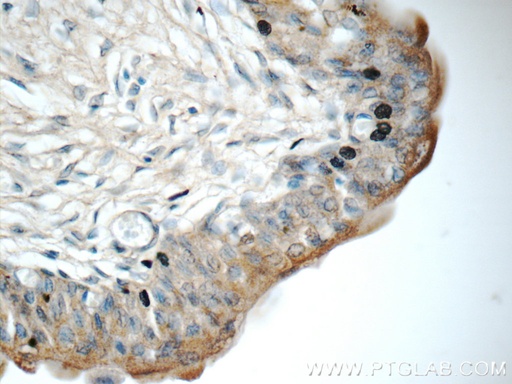 [17347-1-AP-20UL] SDR42E1 Polyclonal antibody