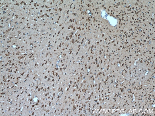 [17348-1-AP-150UL] SLC25A18 Polyclonal antibody