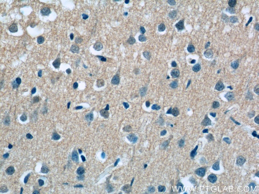 [17351-1-AP-20UL] ASTN2 Polyclonal antibody