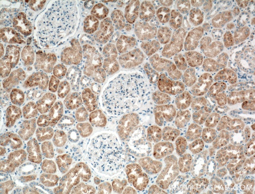 [17353-1-AP-20UL] TIMP-2 Polyclonal antibody