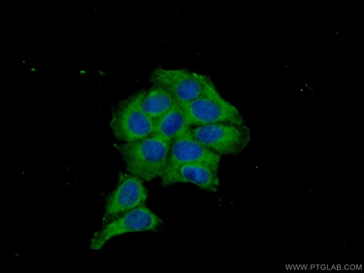 [17354-1-AP-150UL] MKNK2 Polyclonal antibody