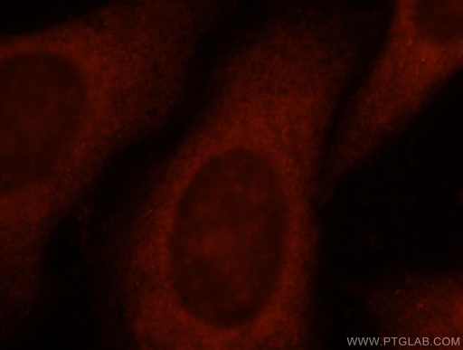 [17355-1-AP-20UL] ACTL7A Polyclonal antibody