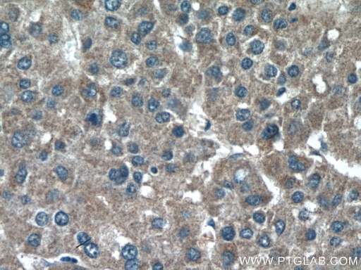 [17356-1-AP-20UL] CHDH Polyclonal antibody