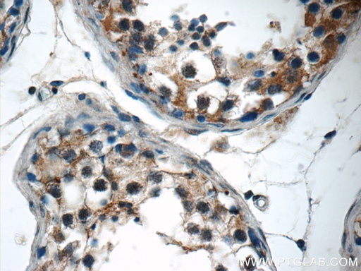 [17357-1-AP-150UL] SPATA16 Polyclonal antibody