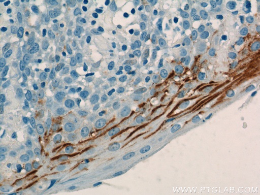 [17361-1-AP-150UL] LY6D Polyclonal antibody