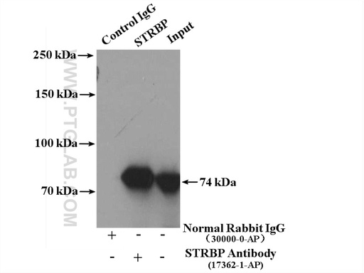 [17362-1-AP-20UL] STRBP Polyclonal antibody