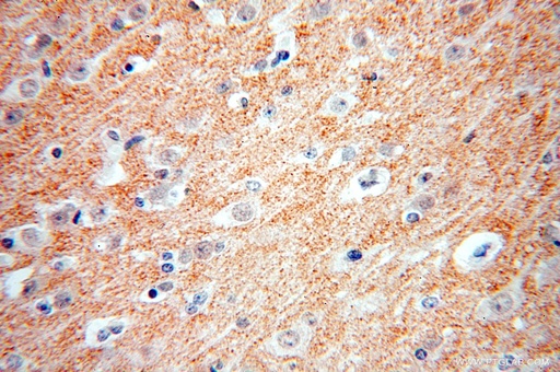 [17363-1-AP-150UL] ZnT3 Polyclonal antibody