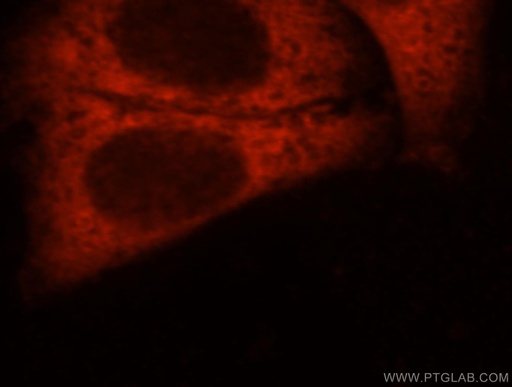 [17364-1-AP-20UL] DNAJC5B Polyclonal antibody