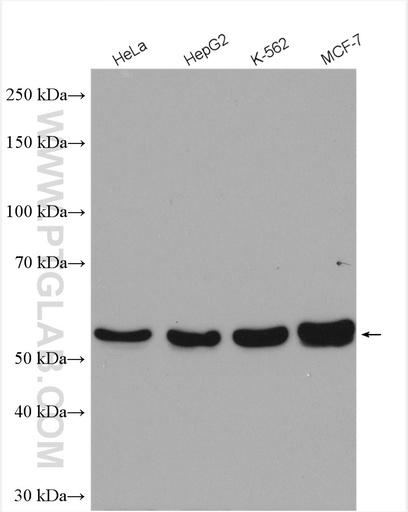 [17367-1-AP-150UL] TADA2B Polyclonal antibody