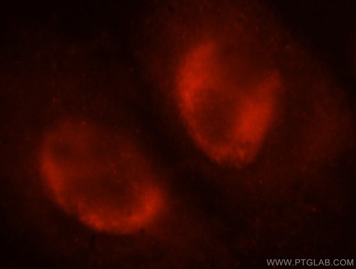 [17368-1-AP-150UL] SNRPA1 Polyclonal antibody