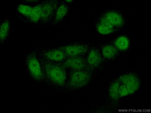 [17373-1-AP-20UL] PADI4 Polyclonal antibody
