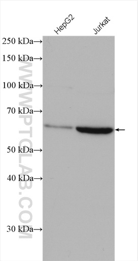 [17375-1-AP-150UL] GPBP1L1 Polyclonal antibody