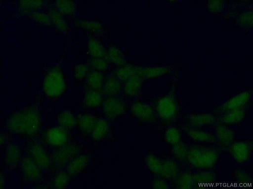 [17376-1-AP-20UL] MAPK11 Polyclonal antibody