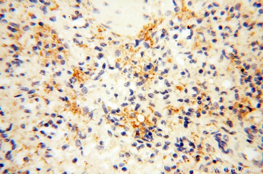 [17387-1-AP-150UL] SAMD4A Polyclonal antibody