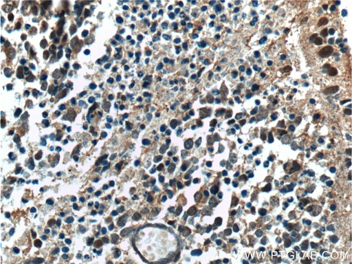 [17388-1-AP-20UL] NRL Polyclonal antibody