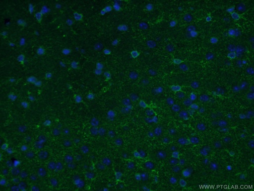 [17390-1-AP-20UL] ALDH1L1 Polyclonal antibody