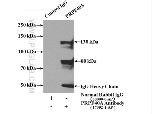 [17392-1-AP-150UL] PRPF40A Polyclonal antibody