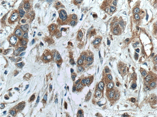 [17393-1-AP-150UL] NUBPL Polyclonal antibody