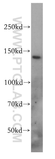[17398-1-AP-150UL] SLC9A11 Polyclonal antibody
