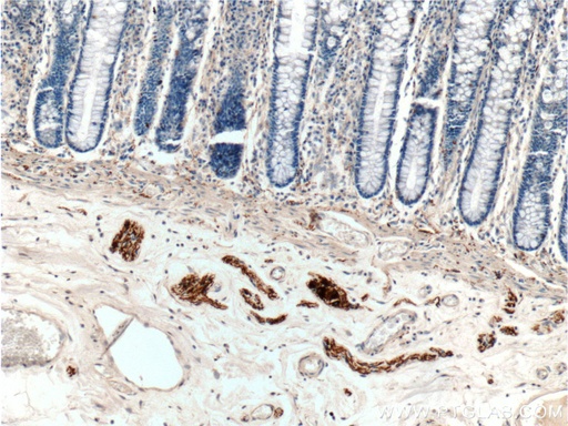 [17399-1-AP-150UL] Peripherin Polyclonal antibody