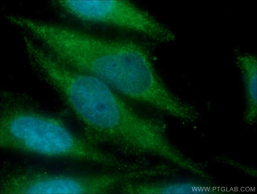 [17400-1-AP-20UL] FGF1 Polyclonal antibody