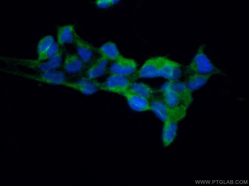 [17401-1-AP-20UL] RPAP2 Polyclonal antibody