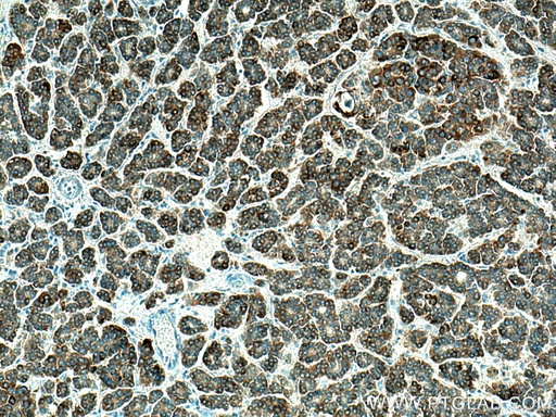 [17402-1-AP-20UL] CXCL12/SDF-1 Polyclonal antibody