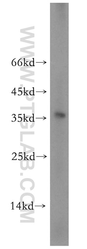 [17405-1-AP-20UL] TGIF2LX Polyclonal antibody
