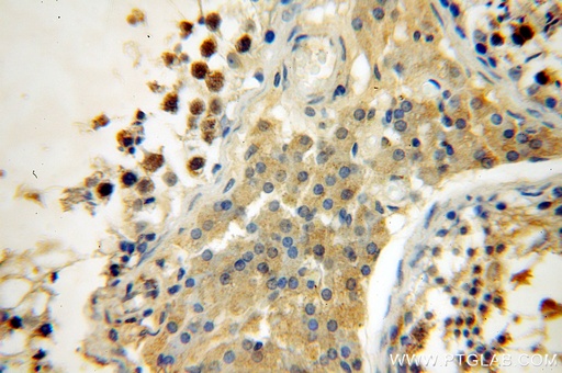 [17406-1-AP-150UL] SYCE1 Polyclonal antibody