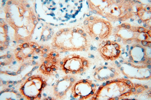[17407-1-AP-150UL] PDCL2 Polyclonal antibody