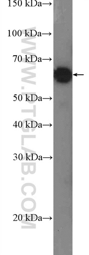 [17414-1-AP-20UL] TESK2 Polyclonal antibody