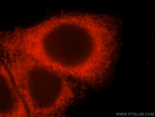 [17415-1-AP-20UL] EVI2A Polyclonal antibody