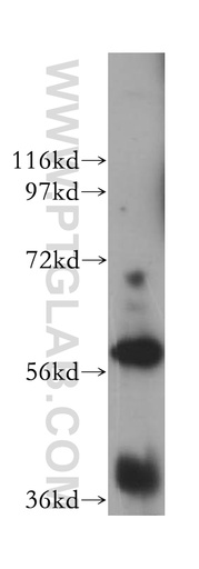 [17416-1-AP-150UL] UTP15 Polyclonal antibody
