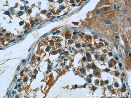 [17417-1-AP-20UL] FJX1 Polyclonal antibody