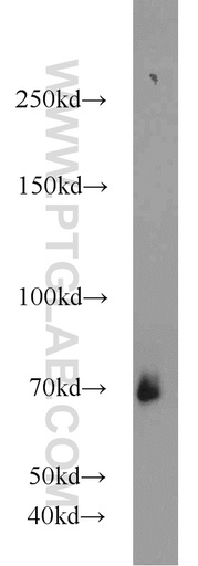 [17420-1-AP-150UL] CSGALNACT2 Polyclonal antibody
