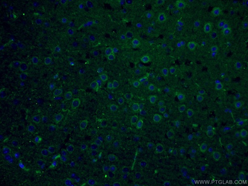 [17421-1-AP-20UL] PLCL2 Polyclonal antibody
