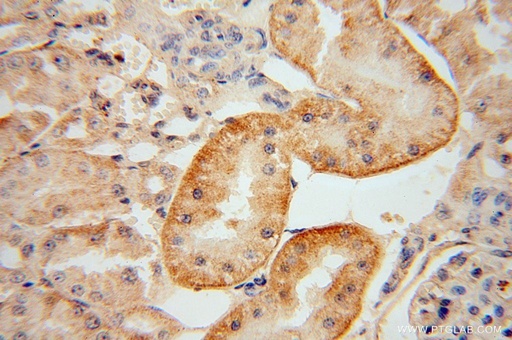 [17422-1-AP-150UL] KIF26B Polyclonal antibody