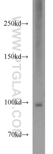 [17427-1-AP-20UL] NARG1L Polyclonal antibody