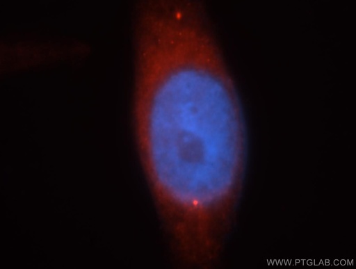 [17430-1-AP-20UL] MAGT1 Polyclonal antibody