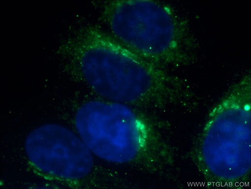 [17435-1-AP-150UL] Transferrin Polyclonal antibody
