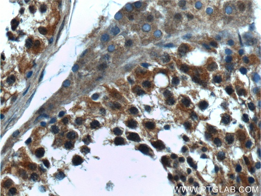 [17438-1-AP-150UL] CTAGE6 Polyclonal antibody