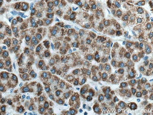[17442-1-AP-150UL] ACADL Polyclonal antibody