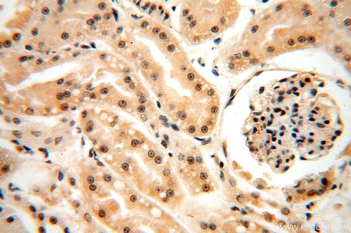 [17449-1-AP-20UL] HDAC4 Polyclonal antibody