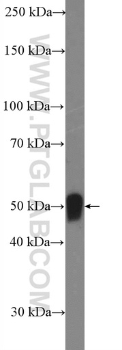 [17451-1-AP-20UL] Vaspin Polyclonal antibody
